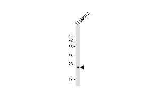 Anti-CFD Antibody (N-term)at 1:2000 dilution + human plasma lysates Lysates/proteins at 20 μg per lane. (Adipsin Antikörper  (N-Term))