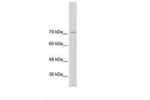 Image no. 2 for anti-General Transcription Factor II I Repeat Domain-Containing 1 (GTF2IRD1) (N-Term) antibody (ABIN203343) (GTF2IRD1 Antikörper  (N-Term))