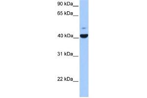 FGFR1OP antibody used at 1 ug/ml to detect target protein. (FGFR1OP Antikörper  (N-Term))