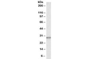 Western blot testing of human liver lysate with CA1 antibody at 0. (CA1 Antikörper)