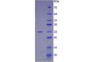 SDS-PAGE (SDS) image for High Mobility Group Box 1 (HMGB1) ELISA Kit (ABIN6574156)