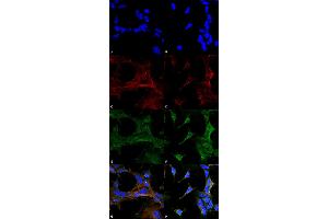 Immunocytochemistry/Immunofluorescence analysis using Mouse Anti-4-Hydroxy-2-hexenal Monoclonal Antibody, Clone 6F10 . (4-Hydroxy-2-Hexenal (4-HHE) Antikörper (PerCP))