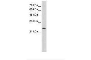 Image no. 1 for anti-Thyroid Stimulating Hormone Receptor (TSHR) (C-Term) antibody (ABIN6736337) (TSH receptor Antikörper  (C-Term))