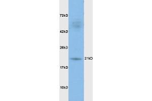 Rat brain lysates probed with Anti DHFR Polyclonal Antibody, Unconjugated (ABIN1387277) at 1:200 in 4 °C. (Dihydrofolate Reductase Antikörper)