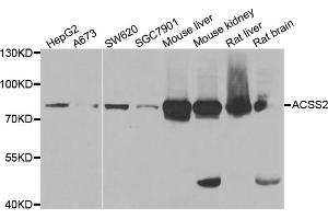 Western blot analysis of extracts of various cell lines, using ACSS2 antibody (ABIN5973869) at 1/1000 dilution. (ACSS2 Antikörper)