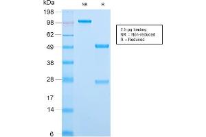 SDS-PAGE (SDS) image for anti-Minichromosome Maintenance Complex Component 7 (MCM7) (AA 195-319) antibody (ABIN6940025)