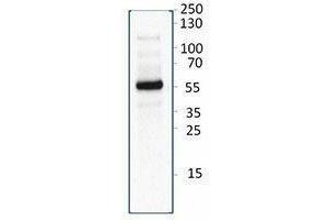 Western Blotting (WB) image for anti-CD209b Antigen (CD209B) antibody (ABIN2666290) (CD209b Antigen (CD209B) Antikörper)