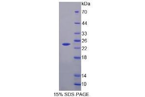 SDS-PAGE analysis of Mouse FLRT1 Protein. (FLRT1 Protein)