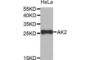 Western Blotting (WB) image for anti-Adenylate Kinase 2 (AK2) antibody (ABIN1678617) (Adenylate Kinase 2 Antikörper)