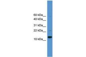 Image no. 1 for anti-Caspase 1 (CASP1) (AA 30-79) antibody (ABIN6745426) (Caspase 1 Antikörper  (AA 30-79))