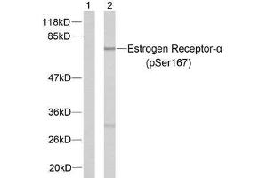 Western blot analysis of extracts from MCF7 cells using Estrogen Receptor-α (phospho-Ser167) antibody (E011073). (Estrogen Receptor alpha Antikörper  (pSer167))