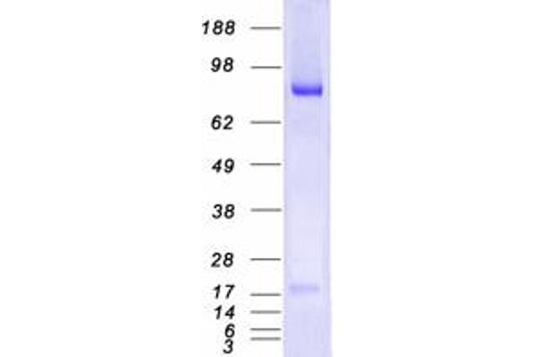 MALT1 Protein (Transcript Variant 1) (Myc-DYKDDDDK Tag)