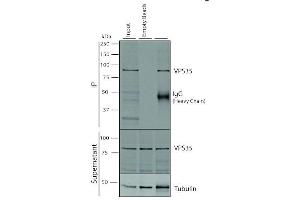 Immunoprecipitation analysis using Mouse Anti-VPS35 Monoclonal Antibody, Clone 5A9 (ABIN6932953). (VPS35 Antikörper  (PerCP))
