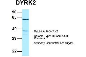 Host: Rabbit  Target Name: DYRK2  Sample Tissue: Human Adult Placenta  Antibody Dilution: 1. (DYRK2 Antikörper  (C-Term))