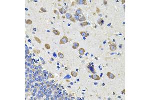 Immunohistochemistry of paraffin-embedded rat brain using GALNT2 Antibody (ABIN5974158) at dilution of 1/100 (40x lens). (GALNT2 Antikörper)