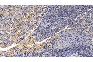 Detection of GITR in Human Spleen Tissue using Polyclonal Antibody to Glucocorticoid Induced Tumor Necrosis Factor Receptor (GITR) (Glucocorticoid Induced Tumor Necrosis Factor Receptor (AA 39-152) Antikörper)