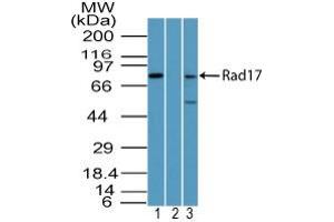 Image no. 1 for anti-RAD17 (RAD17) antibody (ABIN960319) (RAD17 Antikörper)