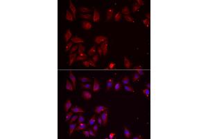 Immunofluorescence analysis of U2OS cells using PDXK antibody (ABIN5974032). (PDXK Antikörper)