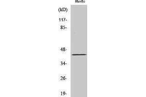 Western Blotting (WB) image for anti-Ret Finger Protein-Like 4A (RFPL4A) (Internal Region) antibody (ABIN6287235) (RFPL4A Antikörper  (Internal Region))