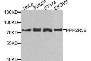 Western blot analysis of extracts of various cell lines, using PPP2R3B antibody (ABIN5974610) at 1/1000 dilution. (PPP2R3B Antikörper)