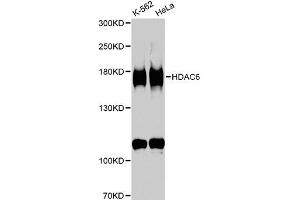 Western blot analysis of extracts of various cell lines, using HDAC6 antibody (ABIN5970867) at 1/1000 dilution. (HDAC6 Antikörper)