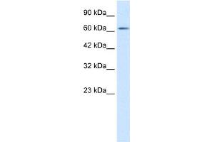 WB Suggested Anti-FLJ12644 Antibody Titration:  1. (FLJ12644 (C-Term) Antikörper)