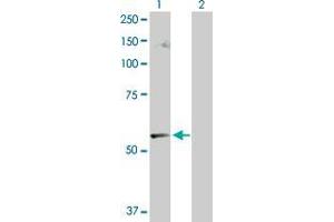 Lane 1: CABC1 transfected lysate ( 71. (CABC1 293T Cell Transient Overexpression Lysate(Denatured))