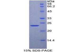 SDS-PAGE analysis of Mouse Cyclophilin D Protein. (PPID Protein)