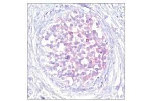 Image no. 1 for anti-V-Raf-1 Murine Leukemia Viral Oncogene Homolog 1 (RAF1) (pSer259) antibody (ABIN196619) (RAF1 Antikörper  (pSer259))
