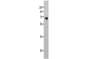 Western Blotting (WB) image for anti-Matrix Metallopeptidase 25 (MMP25) antibody (ABIN2431663) (MMP25 Antikörper)