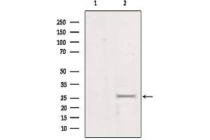 Western blot analysis of extracts from mouse brain, using LGALS3 Antibody. (Galectin 3 Antikörper  (Internal Region))