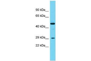 Host:  Rabbit  Target Name:  Cpa2  Sample Type:  Rat Spleen lysates  Antibody Dilution:  1. (Carboxypeptidase A2 Antikörper  (Middle Region))