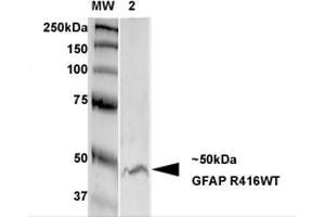 Western Blot analysis of Rat Brain Membrane showing detection of GFAP protein using Mouse Anti-GFAP Monoclonal Antibody, Clone S206B-9 . (GFAP Antikörper  (AA 411-422) (Biotin))