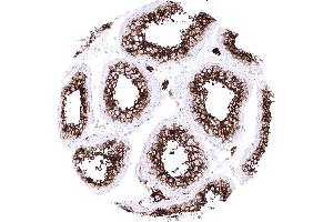 Testis Leydig cells and spermatocytes of the testis show a particularly strong ACE2 immunostaining in the testis (Rekombinanter ACE2 Antikörper  (AA 705-805))