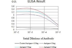 Black line: Control Antigen (100 ng),Purple line: Antigen (10 ng), Blue line: Antigen (50 ng), Red line:Antigen (100 ng) (MSH6 Antikörper  (AA 374-540))