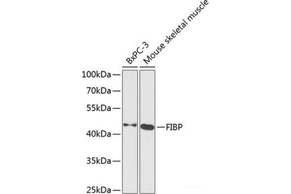 FIBP Antikörper