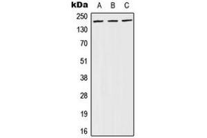 Western blot analysis of BRCA1 (pS1524) expression in A431 (A), NIH3T3 (B), PC12 (C) whole cell lysates. (BRCA1 Antikörper  (C-Term, pSer1524))