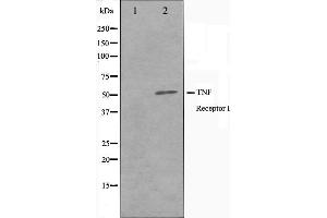 Western blot analysis of TNFR1 Antibody expression in A549 cells lysates. (TNFRSF1A Antikörper  (C-Term))