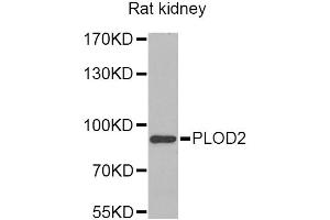 Western blot analysis of extracts of rat kidney, using PLOD2 Antibody. (PLOD2 Antikörper)