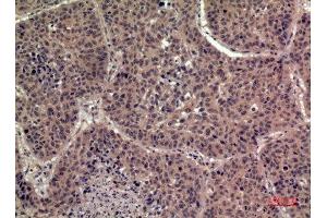 Immunohistochemistry (IHC) analysis of paraffin-embedded Human Lung, antibody was diluted at 1:100. (FIL1h Antikörper  (Internal Region))