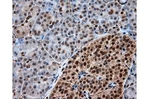 Immunohistochemical staining of paraffin-embedded Kidney tissue using anti-FAHD2A mouse monoclonal antibody. (FAHD2A Antikörper)