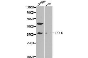 Western Blotting (WB) image for anti-Ribosomal Protein L5 (RPL5) antibody (ABIN1874650) (RPL5 Antikörper)