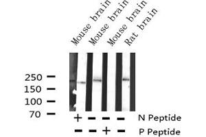 Western blot analysis of Phospho-BRCA1 (Ser1524) Antibody expression in mouse brain and rat brain tissues lysates. (BRCA1 Antikörper  (pSer1524))