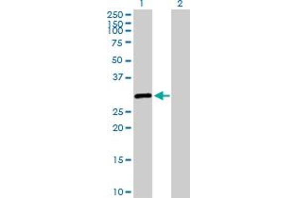 SALL2 Antikörper  (AA 1-198)