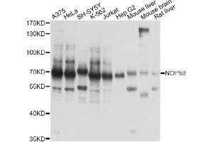 Western blot analysis of extracts of various cell lines, using NOP58 antibody. (NOP58 Antikörper)