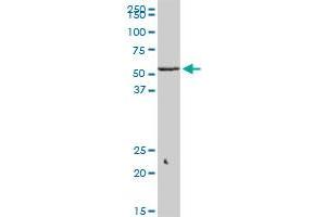 KLF10 monoclonal antibody (M14), clone 2E7. (KLF10/TIEG1 Antikörper  (AA 111-210))