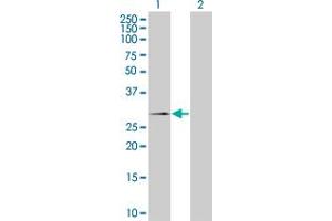 Western Blotting (WB) image for SSX2 293T Cell Transient Overexpression Lysate(Denatured) (ABIN1333583)