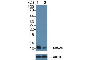 Western Blotting (WB) image for S100 Calcium Binding Protein A6 (S100A6) ELISA Kit (ABIN6730866)