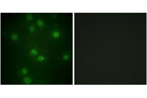 Immunofluorescence analysis of HuvEc cells, using Retinoblastoma (Phospho-Ser811) Antibody. (Retinoblastoma Protein (Rb) Antikörper  (pSer811))