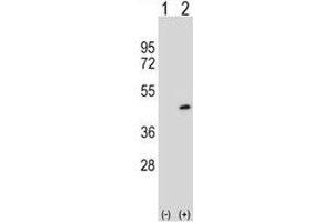 Western blot analysis of PRMT6 antibody and 293 cell lysate either nontransfected (Lane 1) or transiently transfected (2) with the PRMT6 gene. (PRMT6 Antikörper  (AA 19-48))